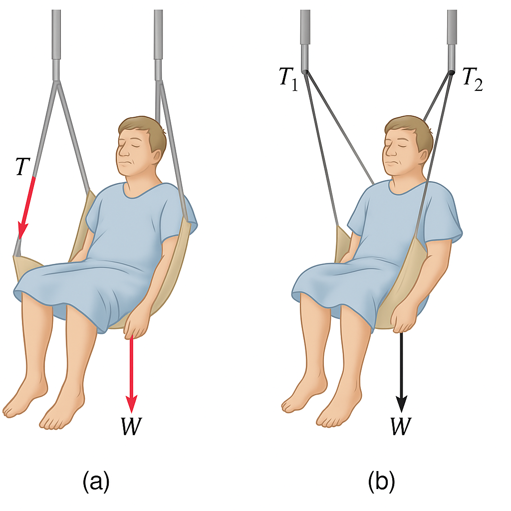A four-part educational diagram illustrating tension and weight forces on a stationary patient supported by an IV pole. (a) A patient’s upper body is suspended upright by a medical strap connected to a cable running through an IV pole hook. (b) The diagram shows two vectors: one pointing upward labeled tension (T), and one pointing downward labeled weight (w), both equal in magnitude. (c) A simplified free-body diagram of the patient’s torso shows only the external forces: an upward arrow labeled T and a downward arrow labeled w. (d) A vector addition diagram demonstrates that the forces balance: T and w have the same length and opposite directions, summing to zero net force.