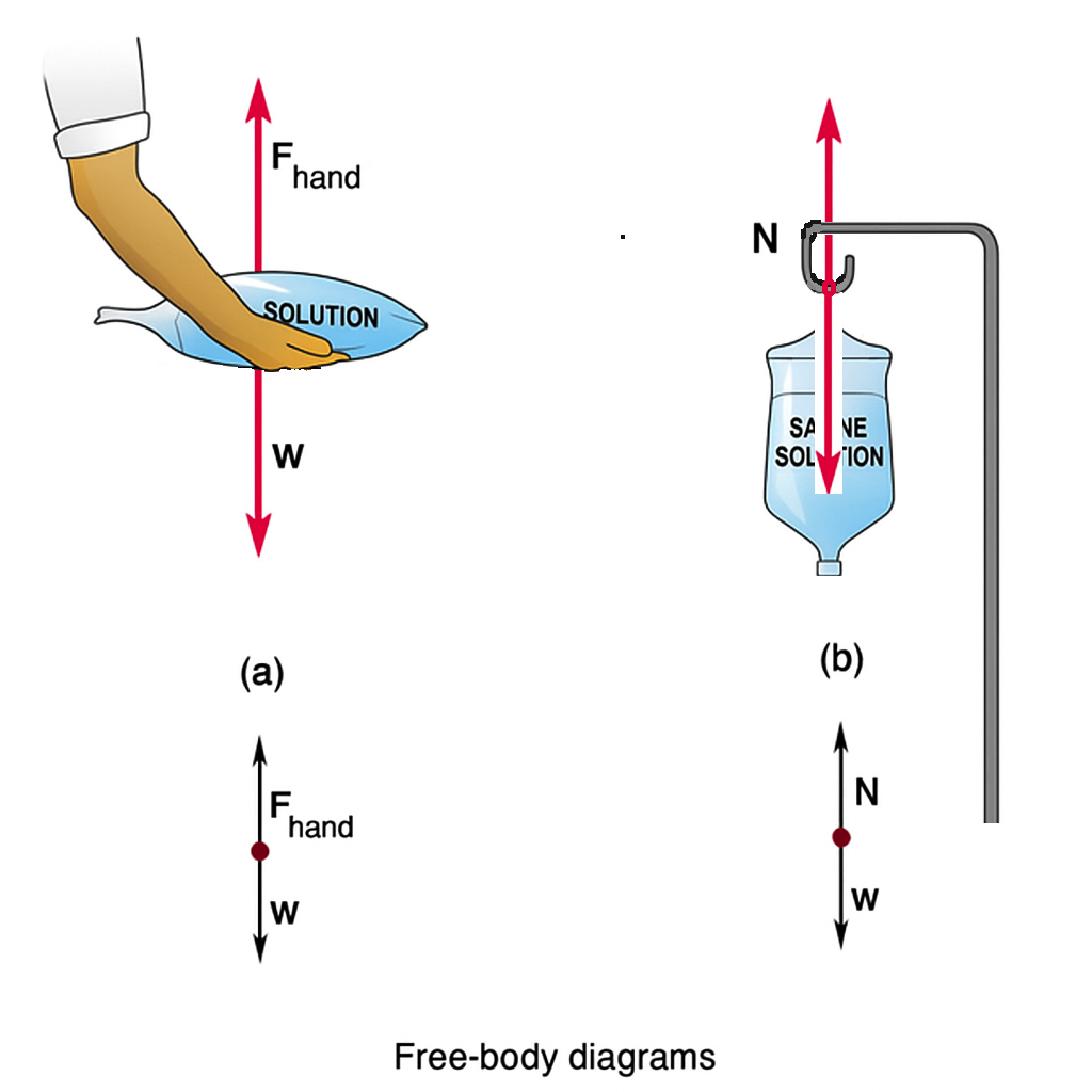 a) A person is holding a bag of saline solution in their hands. The upward force from the hands, labeled [latex]F_{\text{hand}}[/latex], is shown by an arrow pointing up. The weight of the saline bag, labeled [latex]w[/latex], is shown by an equal-length arrow pointing down. The free-body diagram below depicts a red dot with two opposing vectors: [latex]F_{\text{hand}}[/latex] pointing up and [latex]w[/latex] pointing down.(b) The bag of saline solution hangs from a hospital IV pole. A downward arrow labeled [latex]w[/latex] represents the weight of the bag, and an equal-length upward arrow labeled [latex]N[/latex] represents the normal (supporting) force exerted by the pole at the point of contact with the bag. In the corresponding free-body diagram, a red dot has two arrows: [latex]w[/latex] pointing down and [latex]N[/latex] pointing up, both starting at the same point.