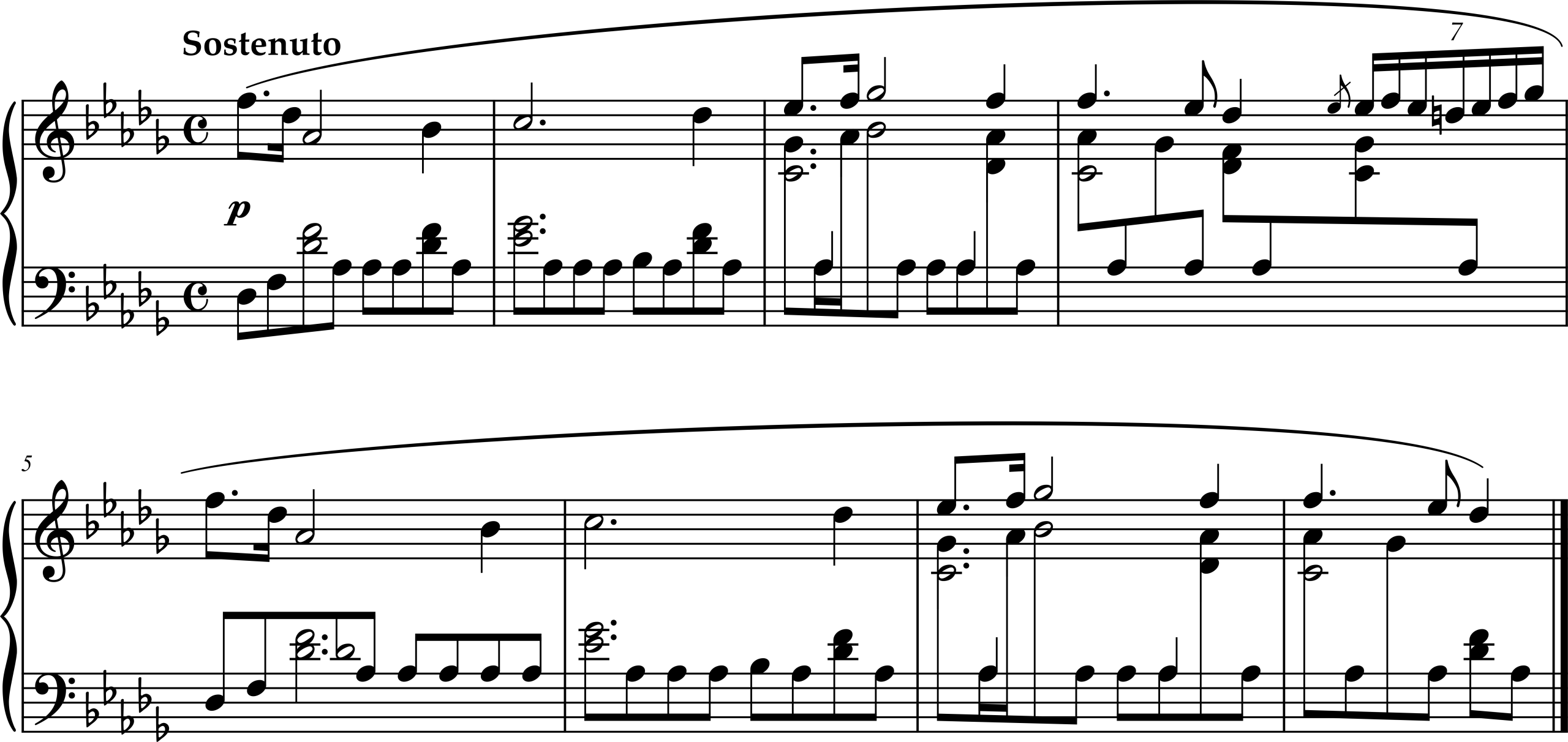 Excerpt from Frédéric Chopin, Prelude for Piano, Opus 28, Number 15