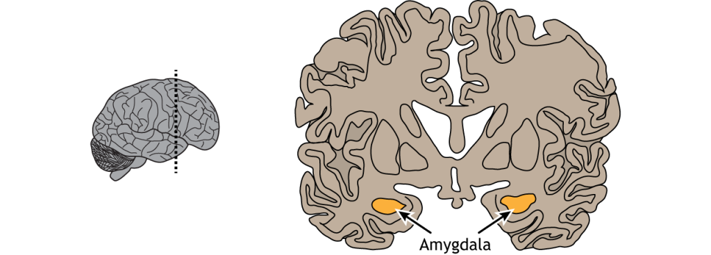 Illustration of a coronal section of the brain showing the location of the amygdala in the temporal lobe.