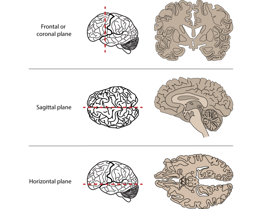Illustrations of anatomical planes and brain slices created by those planes. Details in caption.