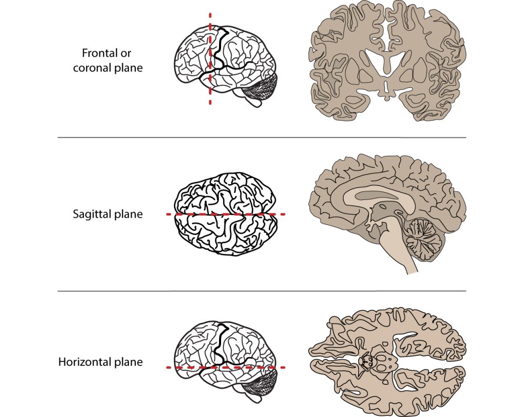 Anatomical Lines Of Division Of The Brain