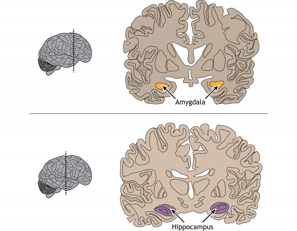 Illustration of coronal brain sections showing the location of the amygdala and hippocampus. Details in caption.
