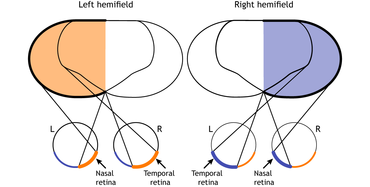 describe the logic of the visual hemifield paradigm