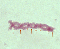 One pair of Two chromsome pairs that are overlapping in several areas (looks like braided yarn). Eight arrows are pointing to spots in the line of chromosomes to places where the red is darker than the rest of the chromosomes.