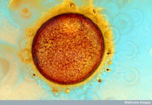 Large orange circle surrounded by a thick dark membrane and that is surrounded by yellow fibers and sperm cells.