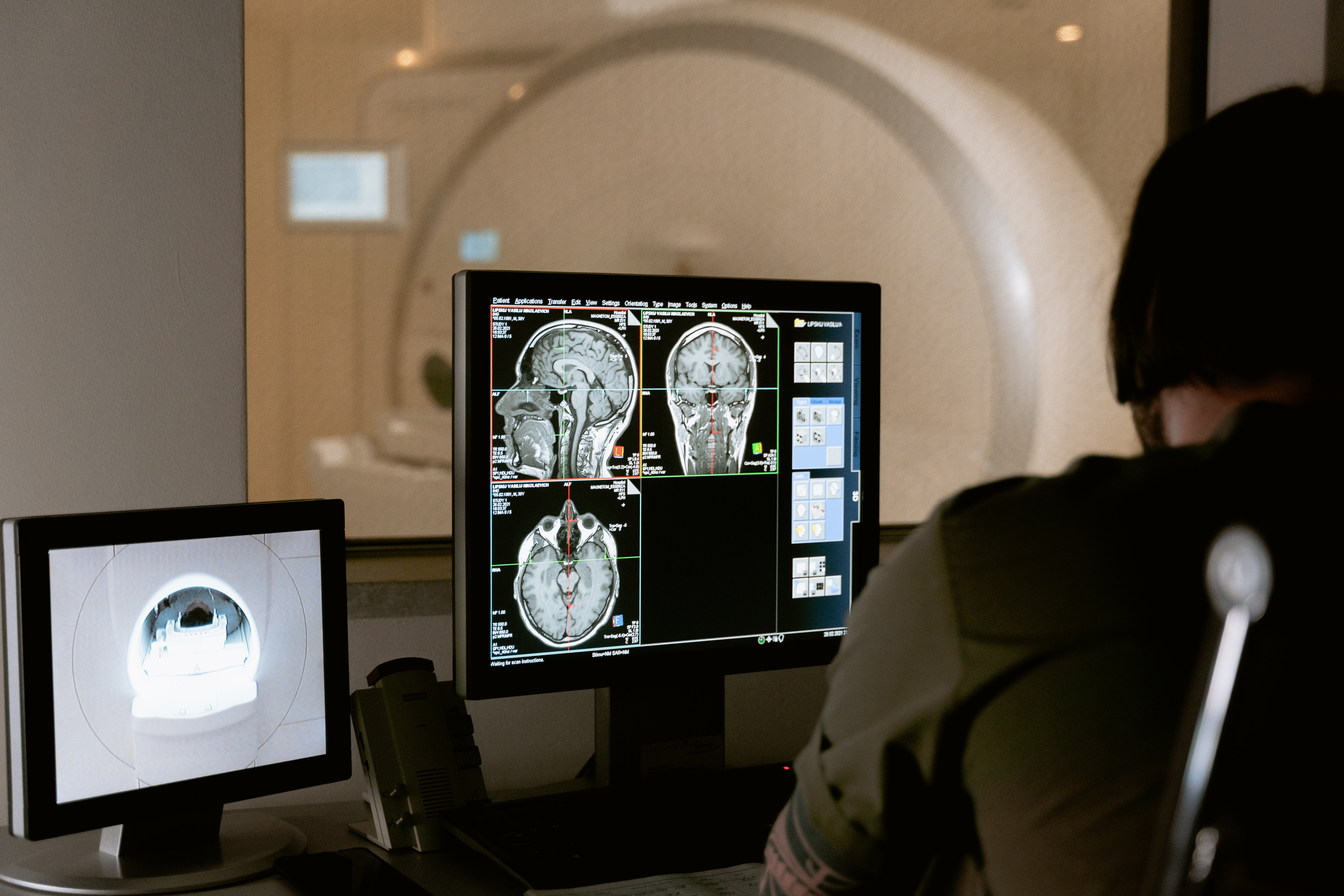 person looking at brain scans on monitor in a laboratory