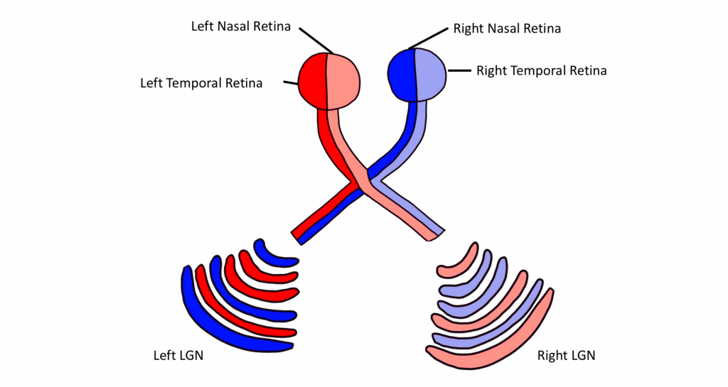 The left nasal retina decussates to the right LGN to layers 1, 4 and 6. The right temporal retina stays ipsilateral and goes to the right LGN layers 2,3 and 5. The right nasal retina decussates to the left LGN layers 1,4, and 6. The left temporal retina stays ipsilateral and goes to the left LGN layers 2, 3, and 5.