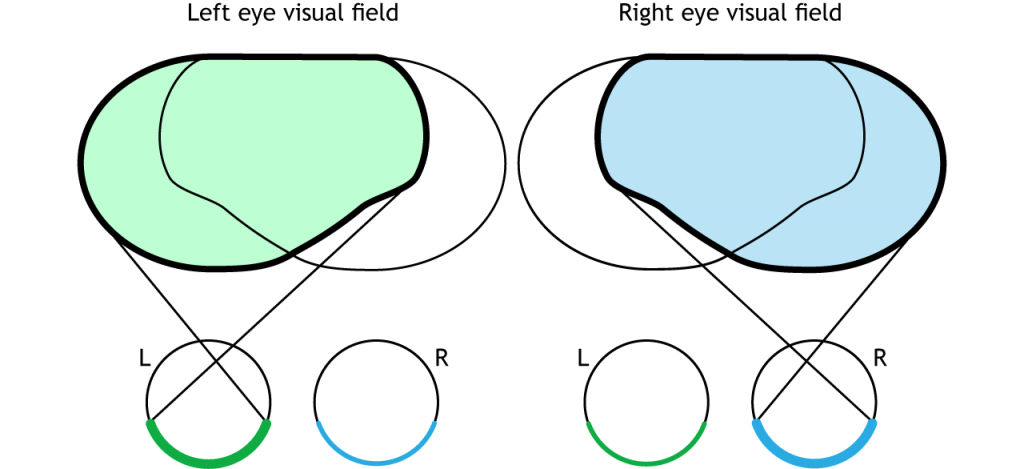 Illustration of single eye visual fields. Details in caption.