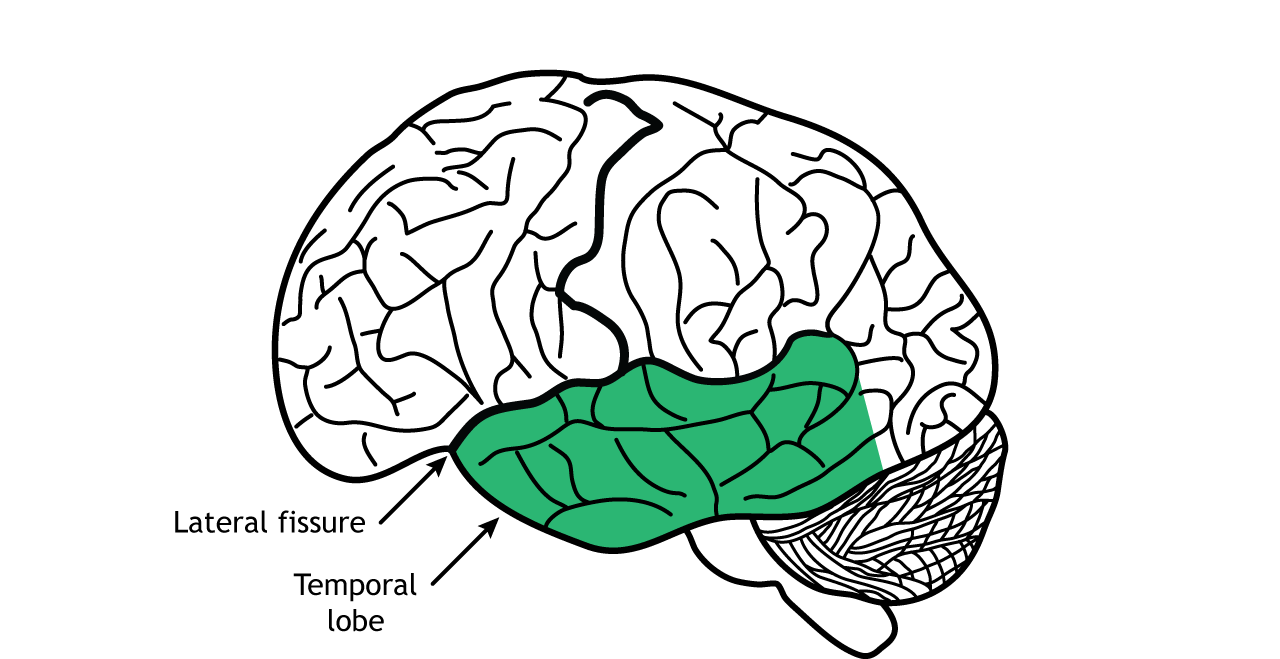 Illustration of the brain showing the temporal lobe. Details in text.
