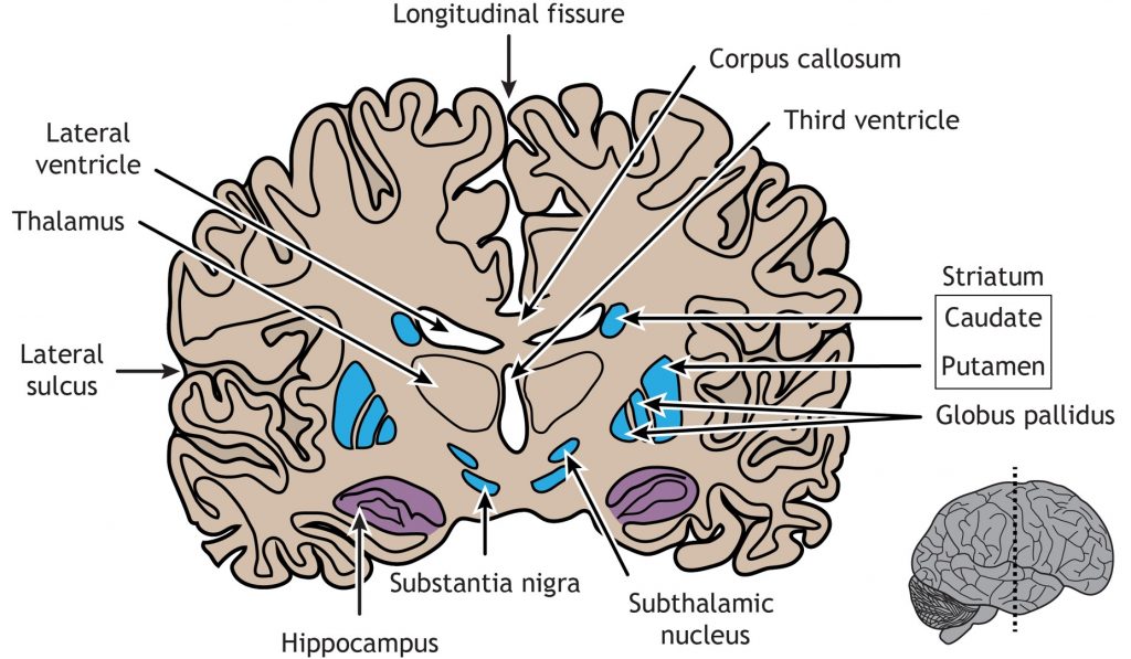 Coronal view of the hippocampus and basal ganglia. Details in text and captions.