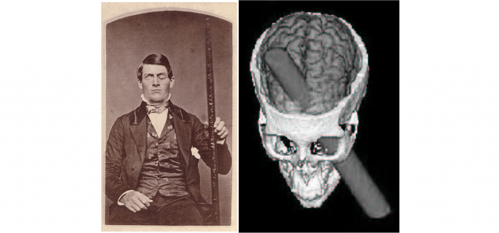 Image of Phineas Gage and a depiction of the damage from his injury. Details provided in the text.