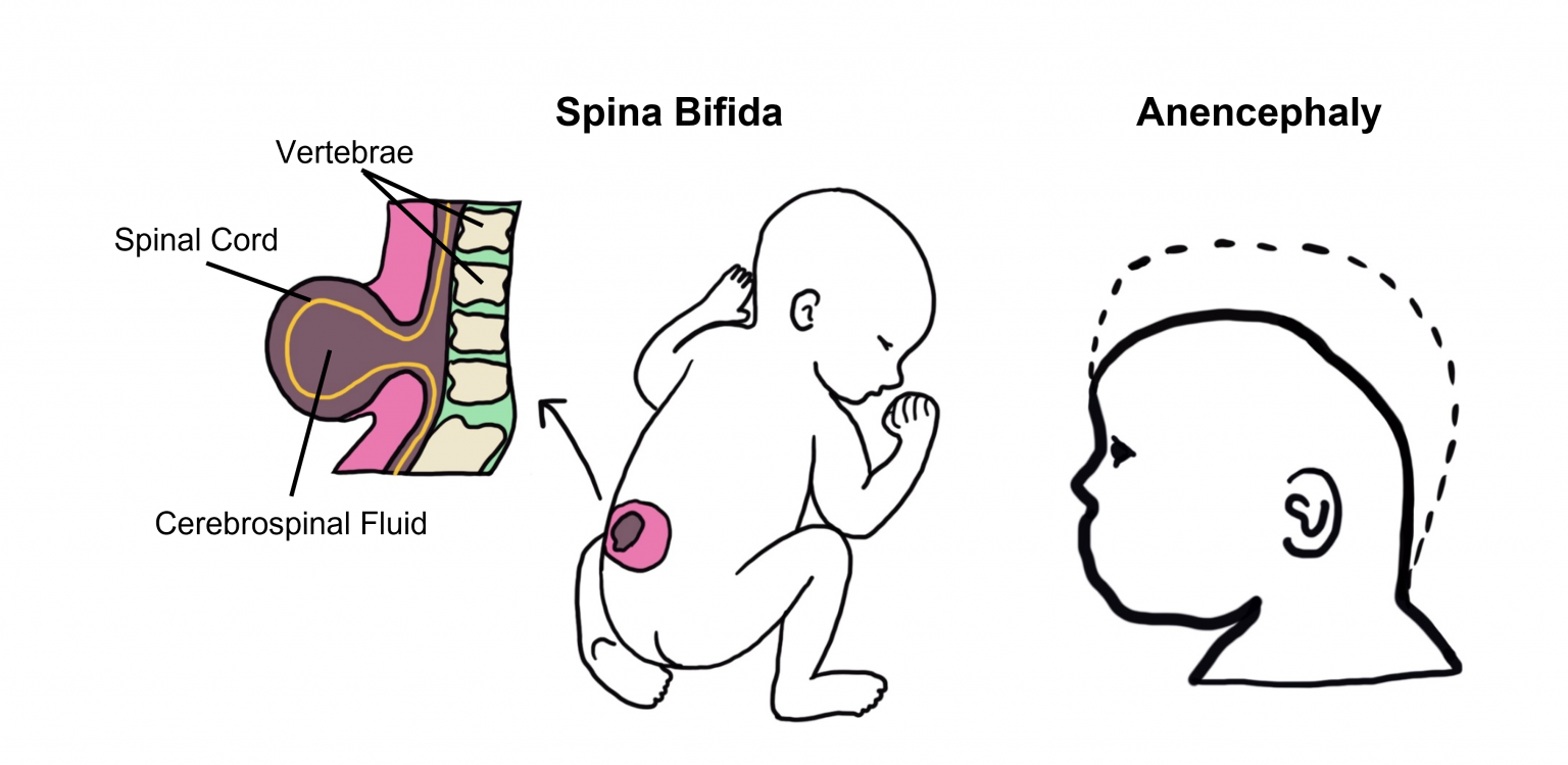 Brain Structure Differentiation Introduction To Neuroscience 1742