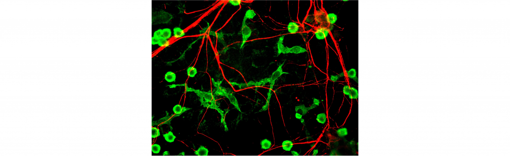 Photograph of microglia and neurons visualized with fluorescent stains. The microglia are much smaller than the neurons.