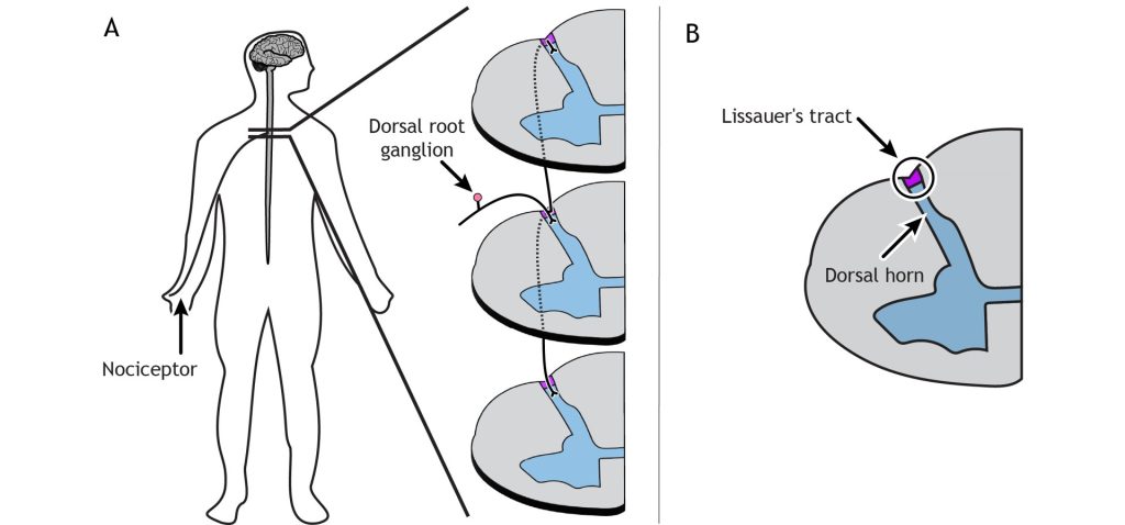 Illustration of nociceptor fibers branching and traveling through Lissauer’s tract. Details in caption and text.