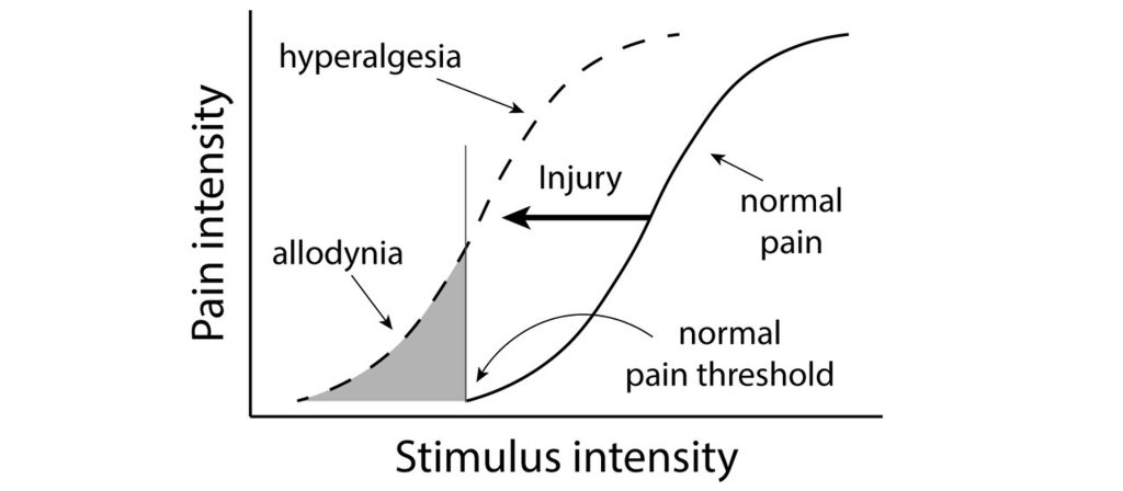 Graph of pain intensity and stimulus intensity. Allodynia and hyperalgesia cause abnormal pain perception. Details in caption and text.