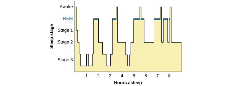 Image of a hypnogram showing the progression of sleep stages throughout the night. Details in caption and text.