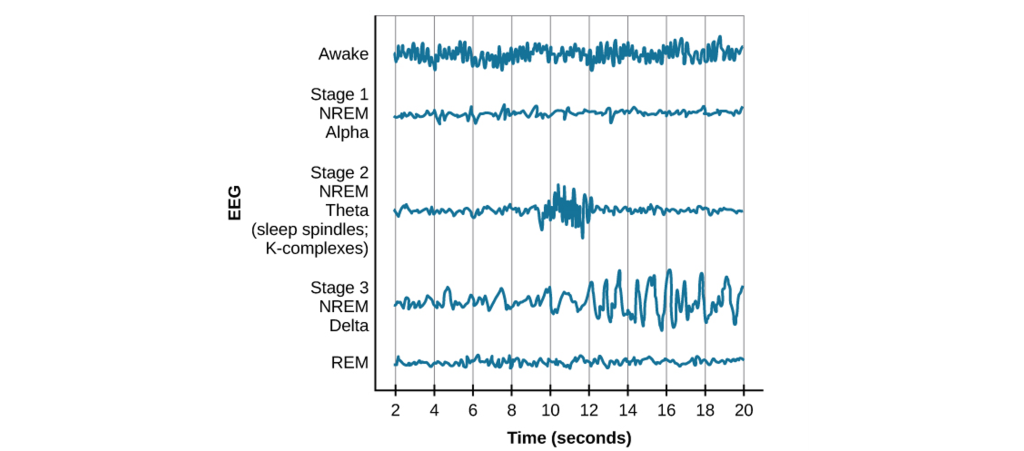 Image of EEG activity during different stages of sleep. Details in caption and text.