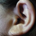 image of ear